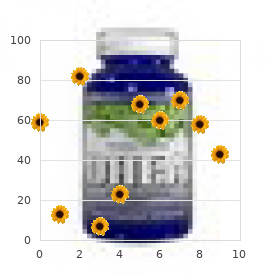 Tricyclic antidepressant overdose